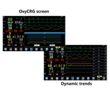 Tragbarer betäubender Überwachungsgerät-Sauerstoff-Analysator TFT 15,6“ LCD